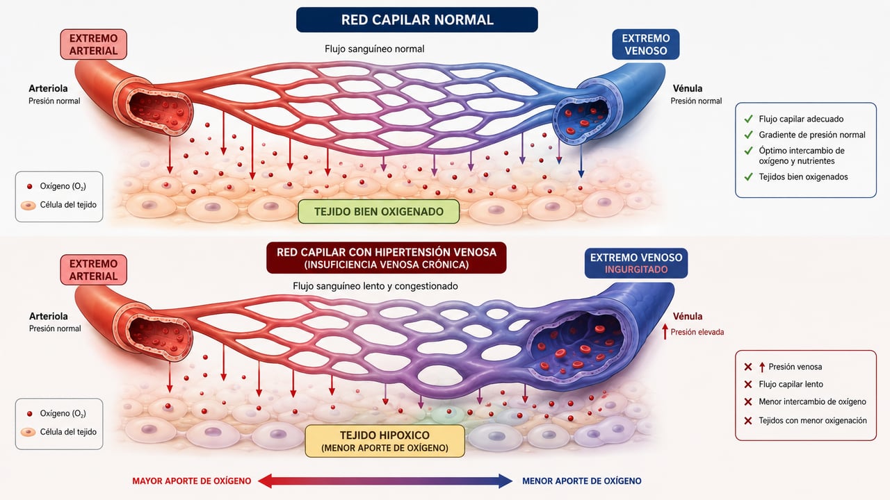 Comparación entre una red capilar normal y una red capilar con hipertensión venosa y tejido hipóxico