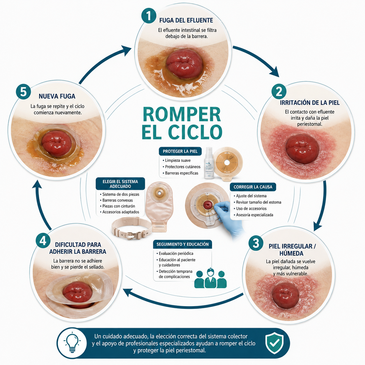 Infografía del ciclo de fuga, irritación de la piel, piel irregular, dificultad para adherir la barrera y nueva fuga